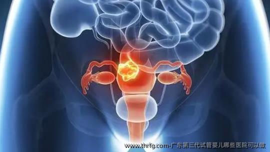广东第三代试管婴儿哪些医院可以做