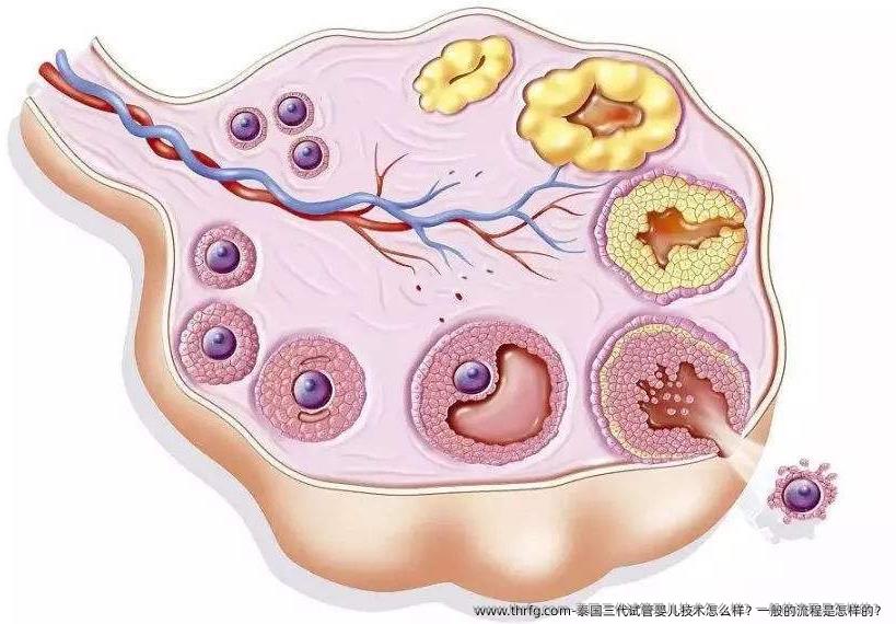 泰国三代试管婴儿技术怎么样？一般的流程是怎样的？