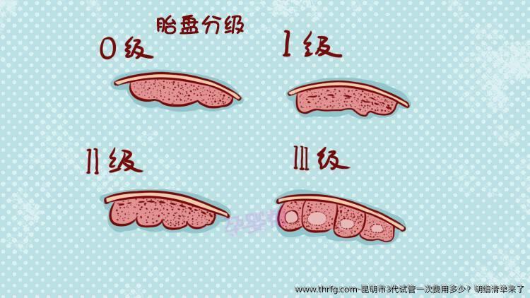 昆明市3代试管一次费用多少？明细清单来了