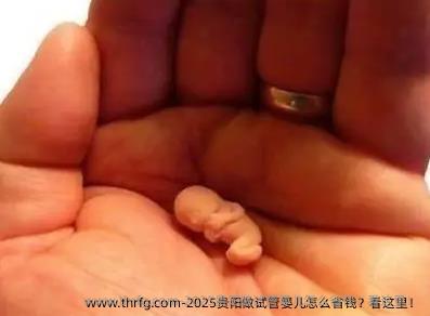 2025贵阳做试管婴儿怎么省钱？看这里！