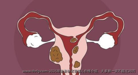 2025年赴泰做试管婴儿价格介绍，大多数一次不超过20万