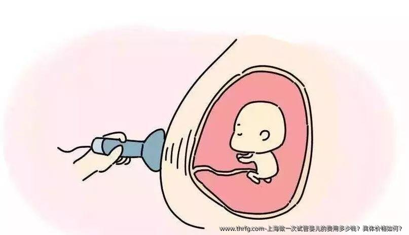 上海做一次试管婴儿的费用多少钱？具体价格如何？
