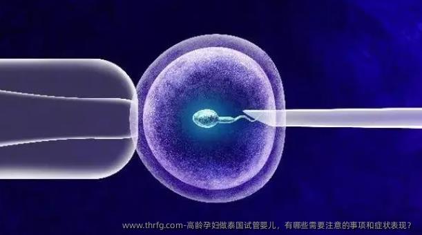 高龄孕妇做泰国试管婴儿，有哪些需要注意的事项和症状表现？