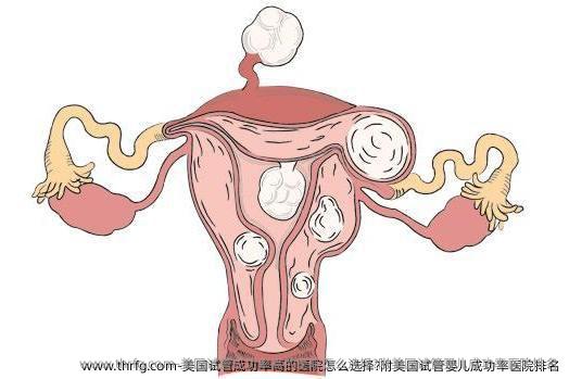 美国试管成功率高的医院怎么选择?附美国试管婴儿成功率医院排名