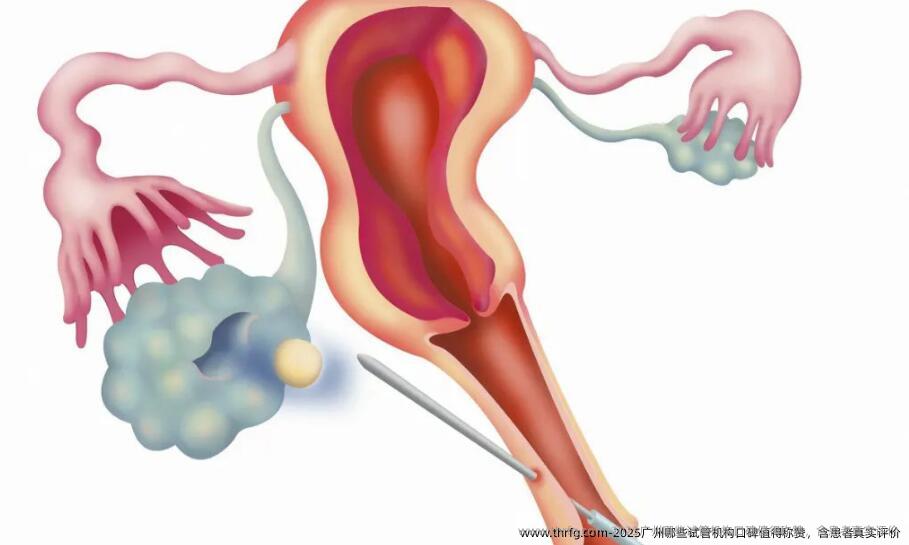 2025广州哪些试管机构口碑值得称赞，含患者真实评价