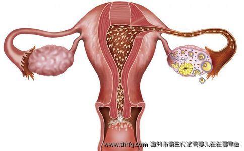 漳州市第三代试管婴儿在在哪里做