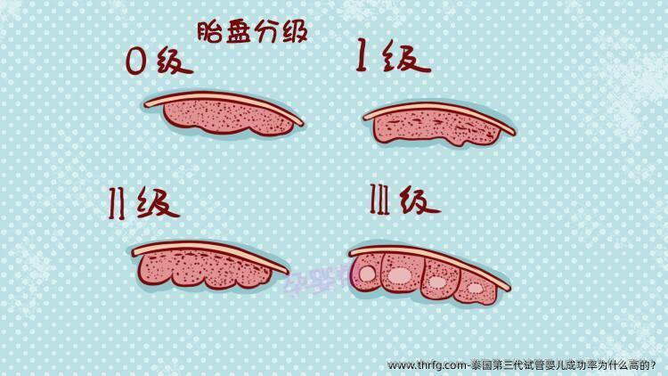 泰国第三代试管婴儿成功率为什么高的？