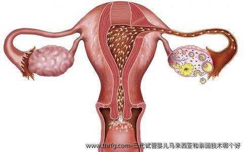 三代试管婴儿马来西亚和泰国技术哪个好