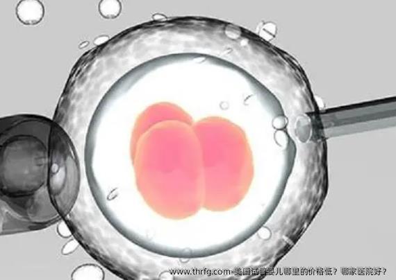 美国试管婴儿哪里的价格低？哪家医院好？