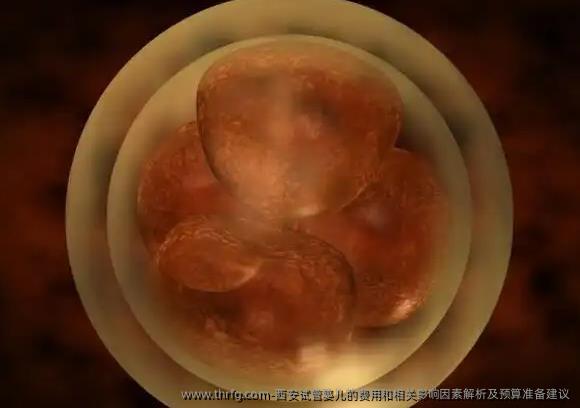 西安试管婴儿的费用和相关影响因素解析及预算准备建议