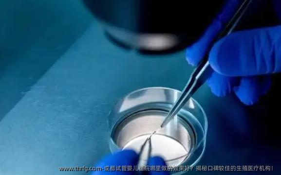 成都试管婴儿医院哪里做的效果好？揭秘口碑较佳的生殖医疗机构！