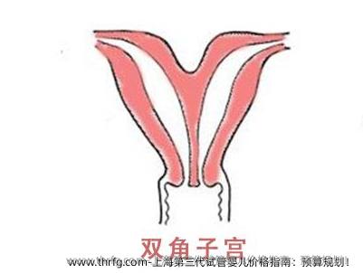 上海第三代试管婴儿价格指南：预算规划！
