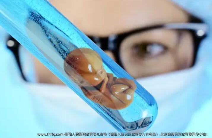 朝阳人民医院试管婴儿价格,北京朝阳医院试管费用多少钱！