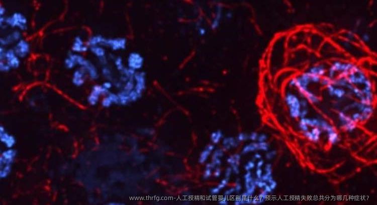 人工授精和试管婴儿区别是什么？预示人工授精失败总共分为哪几种症状？