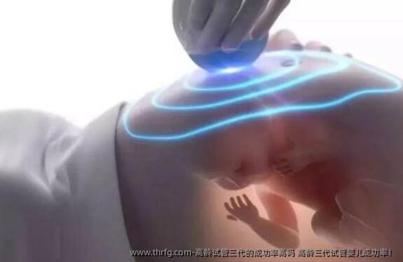 高龄试管三代的成功率高吗 高龄三代试管婴儿成功率！