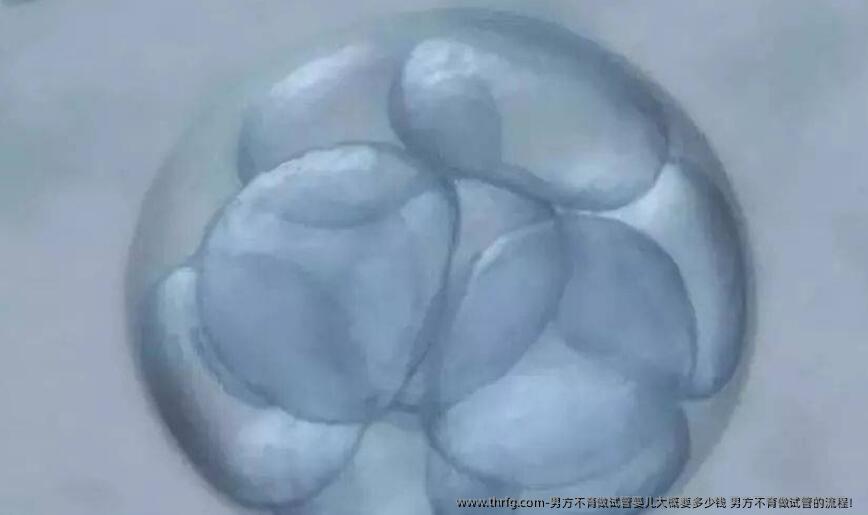 男方不育做试管婴儿大概要多少钱 男方不育做试管的流程！