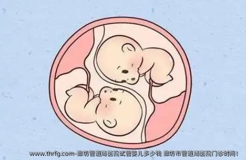 廊坊管道局医院试管婴儿多少钱 廊坊市管道局医院门诊时间！
