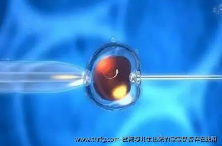 试管婴儿生出来的宝宝是否存在缺陷