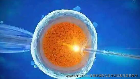 多囊卵巢综合征手术后要注意的事项
