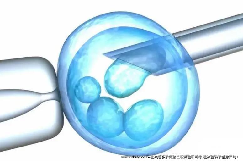 宫颈管狭窄做第三代试管价格表 宫颈管狭窄能顺产吗！