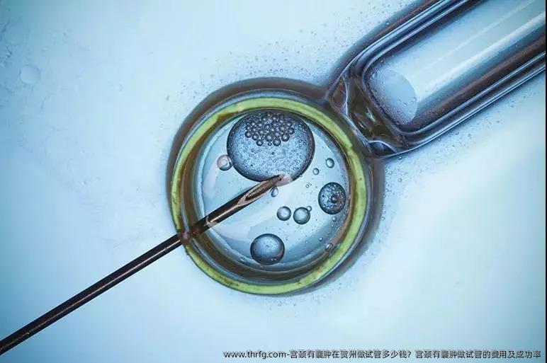 宫颈有囊肿在贺州做试管多少钱？宫颈有囊肿做试管的费用及成功率