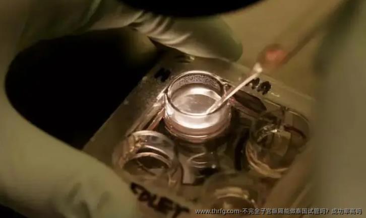 不完全子宫纵隔能做泰国试管吗？成功率高吗