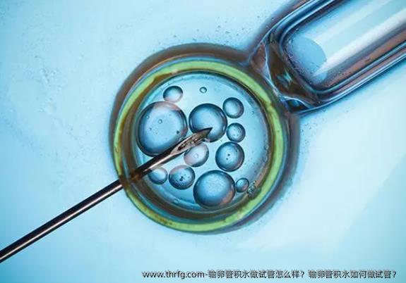 输卵管积水做试管怎么样？输卵管积水如何做试管？