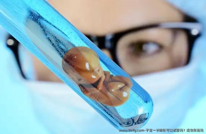 子宫一半畸形可以试管吗？成功率高吗
