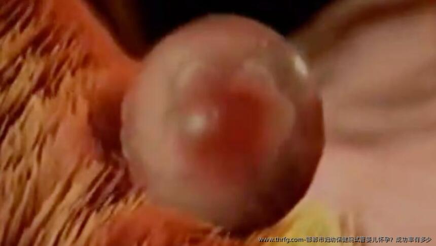 邯郸市妇幼保健院试管婴儿怀孕？成功率有多少