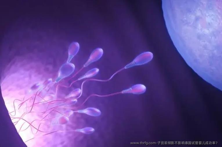 子宫前倾影不影响泰国试管婴儿成功率？