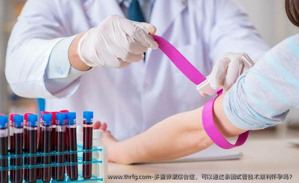 多囊卵巢综合症，可以通过泰国试管技术顺利怀孕吗？