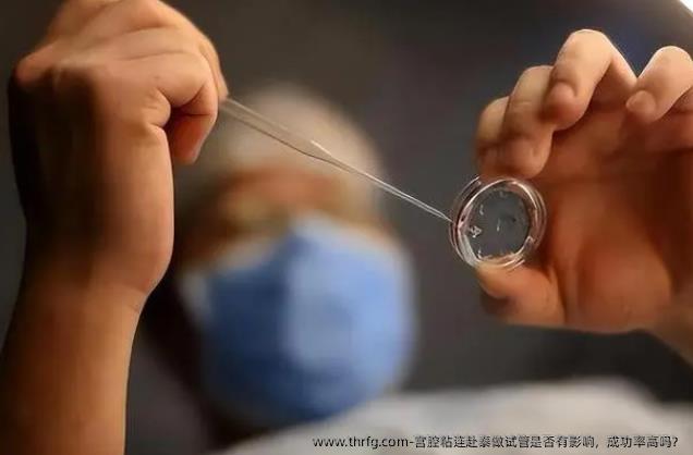 宫腔粘连赴泰做试管是否有影响，成功率高吗？