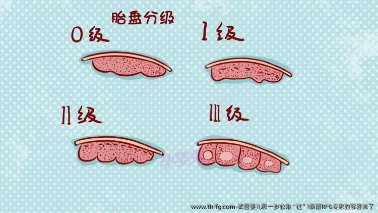 试管婴儿哪一步较难“过”?泰国RFG专家的解答来了
