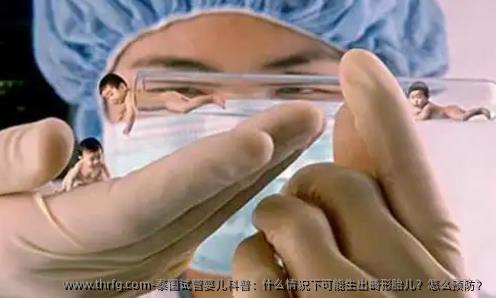 泰国试管婴儿科普：什么情况下可能生出畸形胎儿？怎么预防？