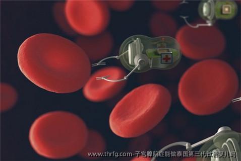 子宫腺肌症能做泰国第三代试管婴儿吗
