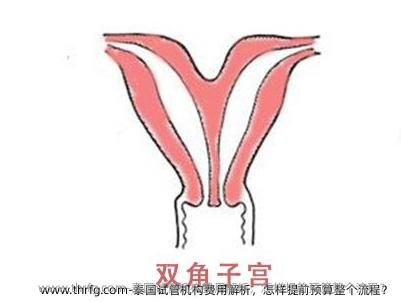 泰国试管机构费用解析，怎样提前预算整个流程？