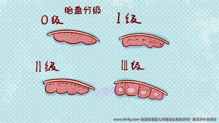泰国试管婴儿玛祖医生真的好吗？真实评价告诉你