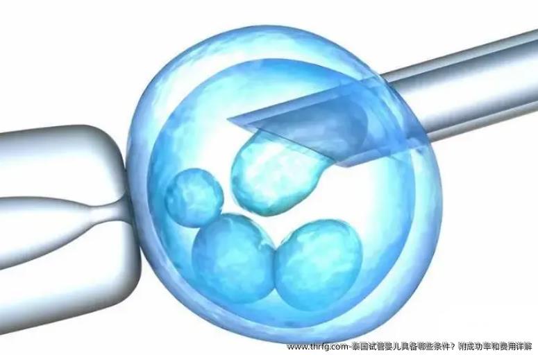 泰国试管婴儿具备哪些条件？附成功率和费用详解