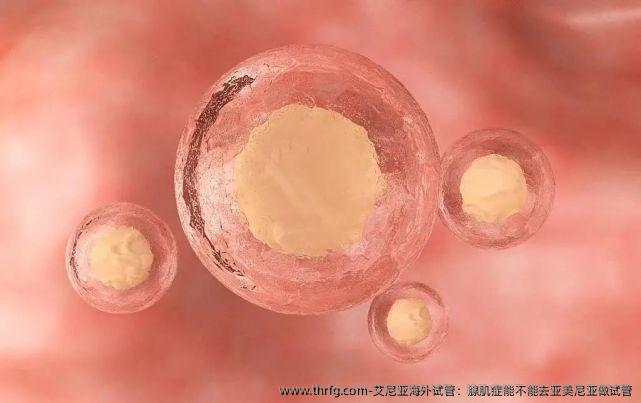 艾尼亚海外试管：腺肌症能不能去亚美尼亚做试管