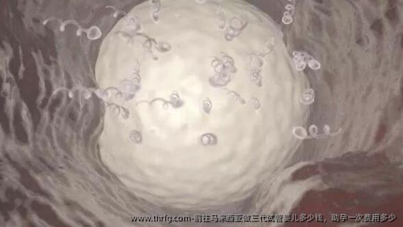 前往马来西亚做三代试管婴儿多少钱，助孕一次费用多少