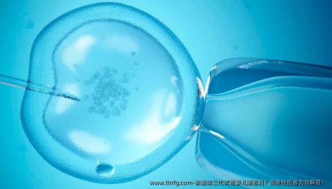 泰国做三代试管婴儿痛苦吗？亲身经历者为你解答！