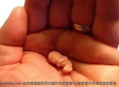 山东哪些医院可以做三代试管婴儿?做试管几代成功率比较高