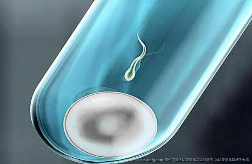 男性不育做试管婴儿怎么取精子?做试管婴儿取精子疼吗