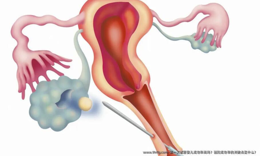 第一次试管婴儿成功率高吗？医院成功率的关键点是什么？