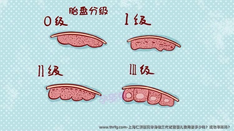 上海仁济医院单身做三代试管婴儿费用要多少钱？成功率高吗？