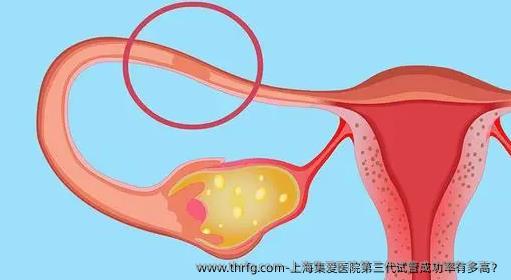 上海集爱医院第三代试管成功率有多高？