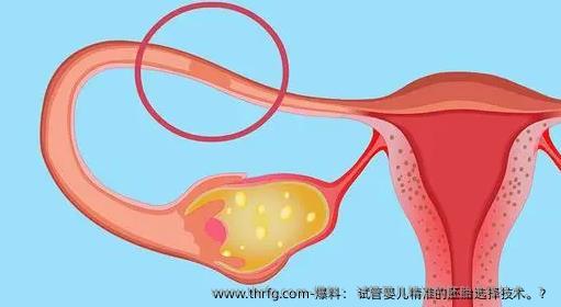 爆料： 试管婴儿精准的胚胎选择技术。？