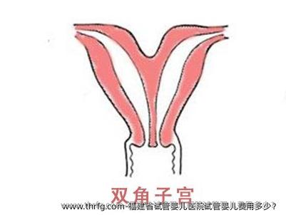 福建省试管婴儿医院试管婴儿费用多少？
