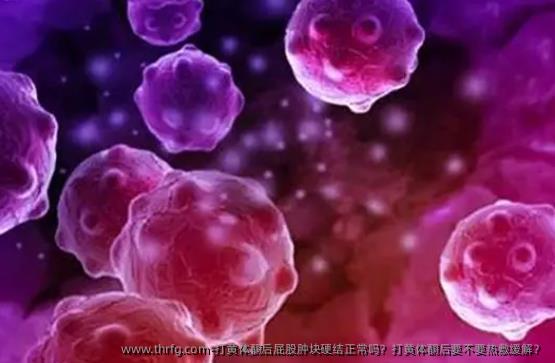 打黄体酮后屁股肿块硬结正常吗？打黄体酮后要不要热敷缓解？