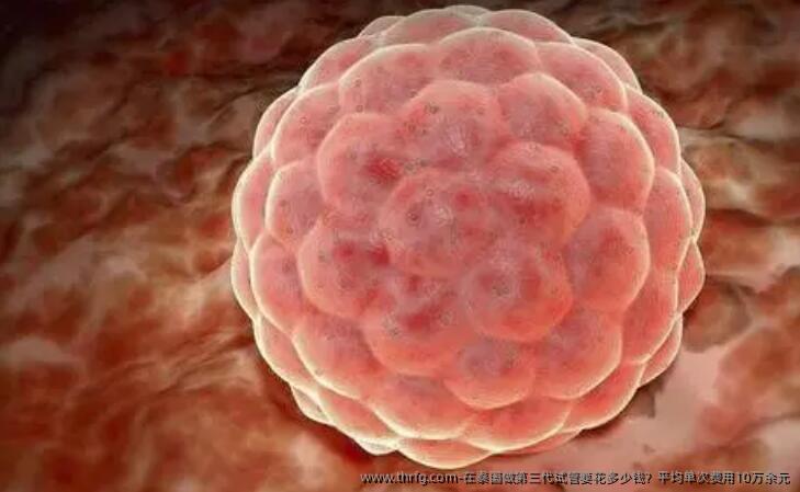 在泰国做第三代试管要花多少钱？平均单次费用10万余元